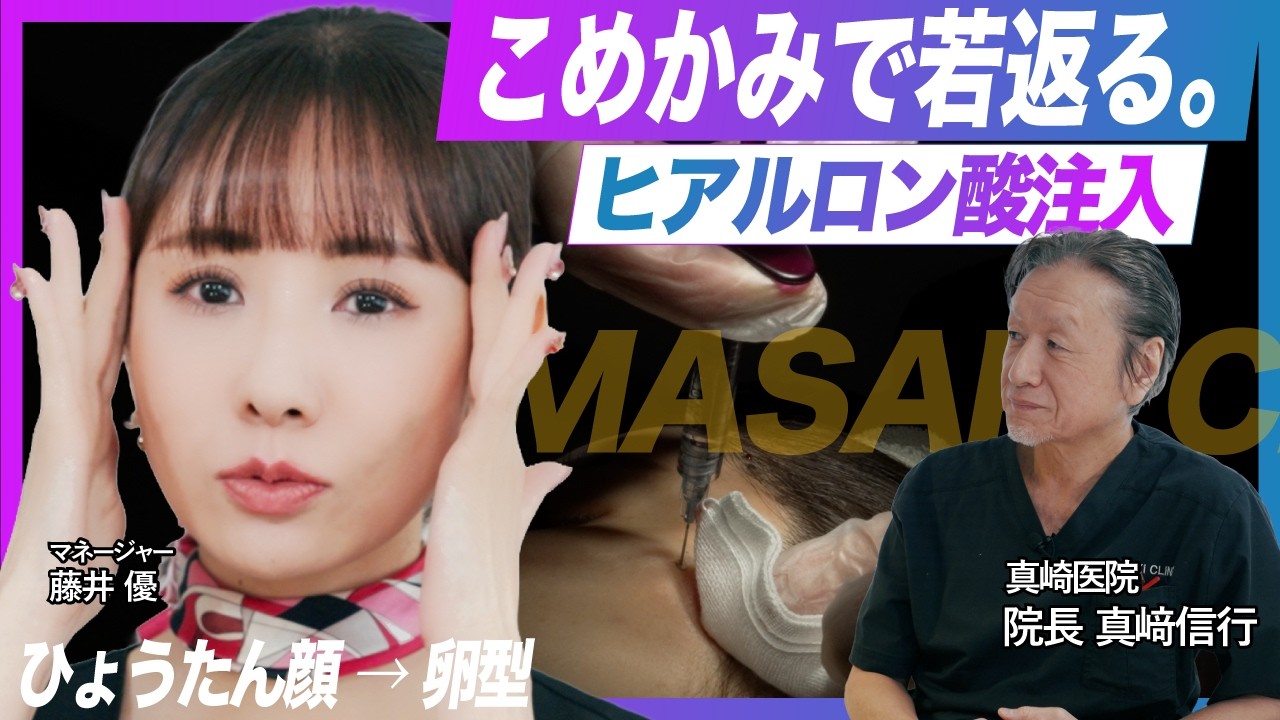こめかみヒアルロン酸はなぜ人気？即実感×溶かせる安心の真実【真﨑信行医師】