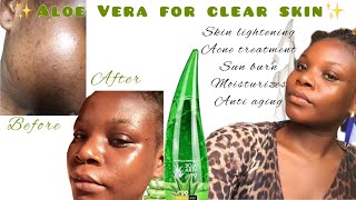 HOW TO USE ALOE VERA FOR CLEAR SKIN ✨ How to use aloe Vera to clear dark spot, acne and acne scars ✨