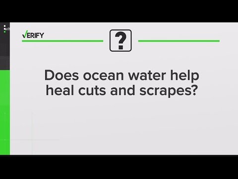 Is seawater good for open wounds?