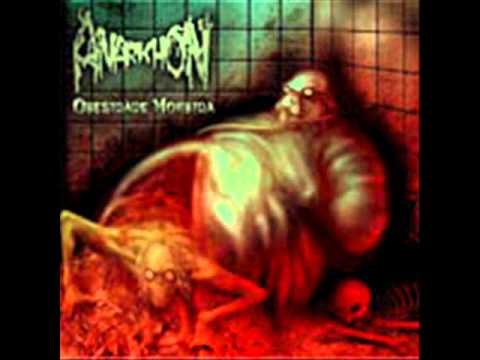 Anarkhon - Execução Fetal