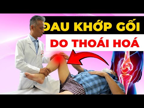 Đau Khớp Gối Thoái Hóa: Tại Sao Không Thể Đi, Leo Cầu Thang & Cách Chữa Trị