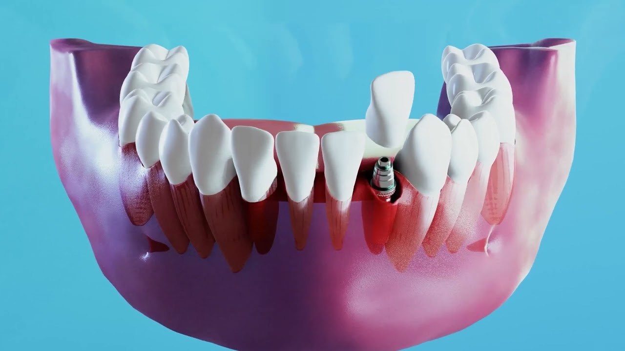 YouTube Thumbnail
