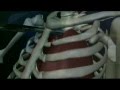 Excedrin Tension Headache