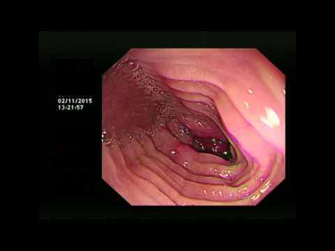 The Feline Oesophagus