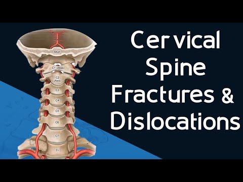 Traumatismes du Rachis Cervical