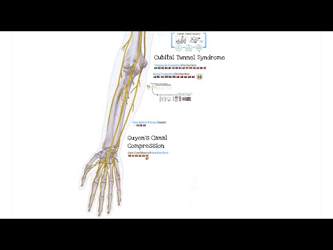 Cubital Tunnel Syndrome (Feat. Dr. Mackinnon)