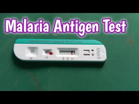 Malaria PF/PV Ag (50 test)