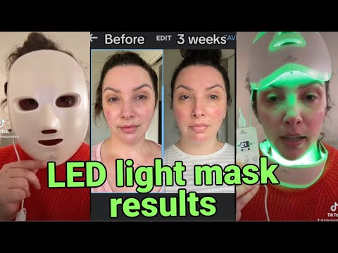 I tried a LED light mask for 3 weeks
