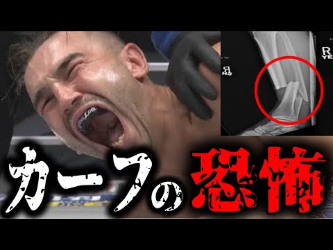 【放送禁止】恐ろしすぎるカーフキックKO試合５選【格闘技】Calf Kick