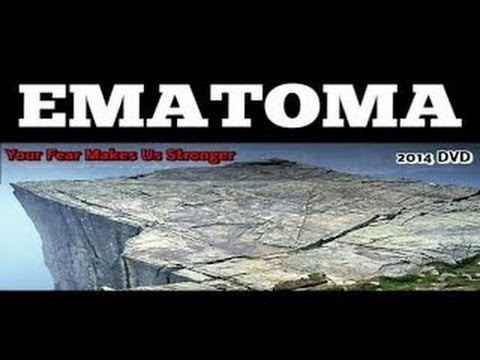 Ematoma 