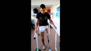 First time on prosthetic leg with hip disarticulation