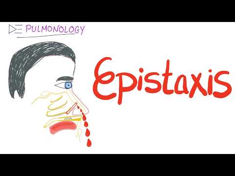 Epistaxis (nosebleed) - Causes and Treatment