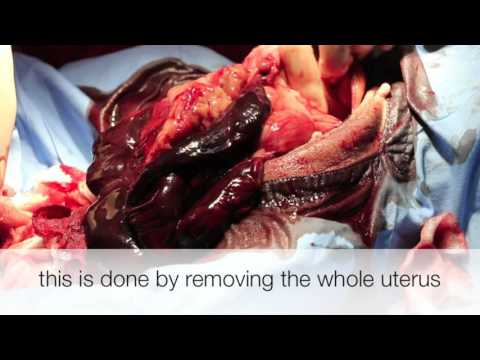 download lagu mp3 mp4 Stomorgyl, download lagu Stomorgyl gratis, unduh video klip Stomorgyl