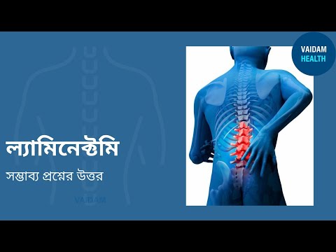 ল্যামিনেকটমি- প্রায়শই জিজ্ঞাসিত প্রশ্ন