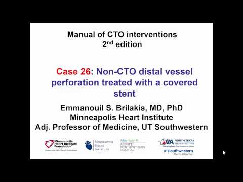 Case 26: Manual of CTO Interventions - Distal vessel perforation treated with covered stent