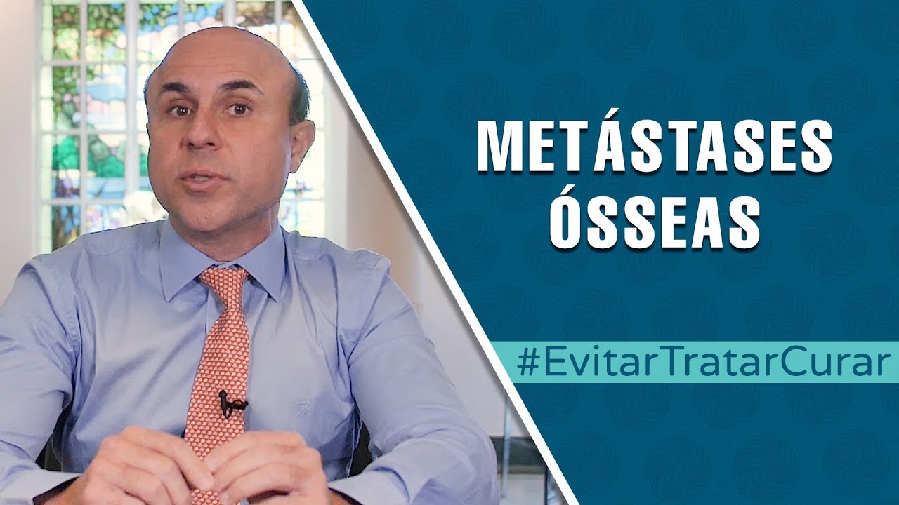 Metástases ósseas podem ser tratadas | Evitar Tratar Curar #29