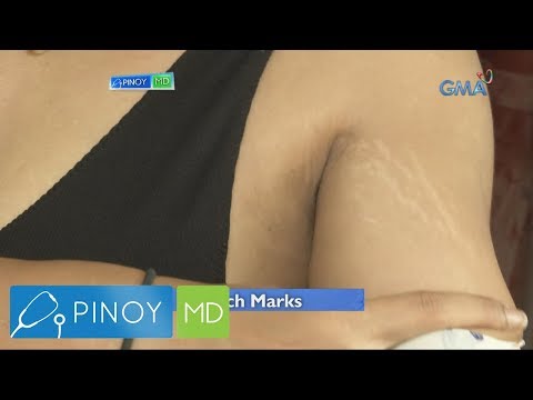 Massager slimming at mga presyo Slimming na may halaman ng misteltu puti at lime