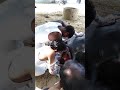 Prolapse In Buffalo