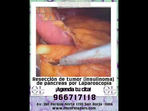 Alexander Alonso Lázaro Chumbe-28