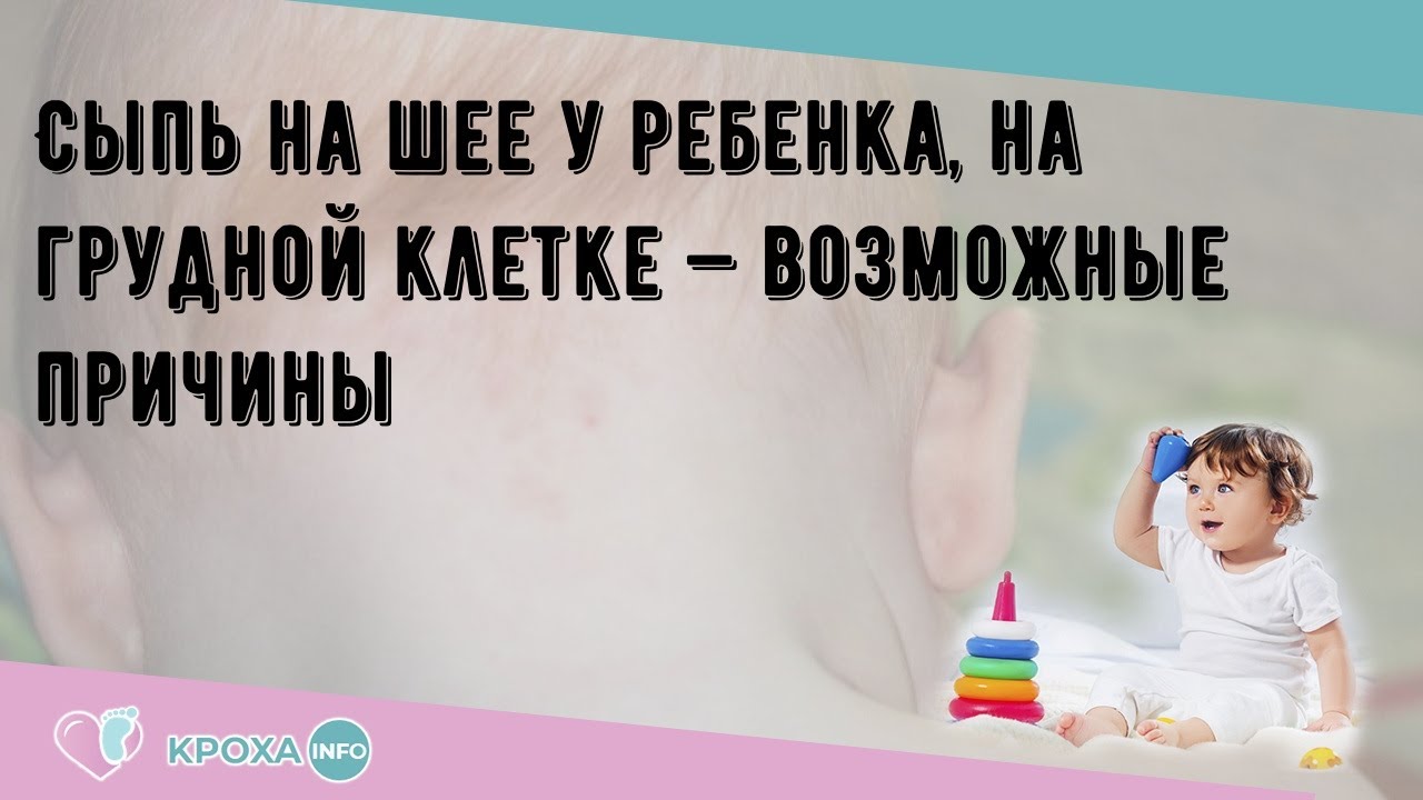 Сыпь на шее у ребенка, на грудной клетке — возможные причины