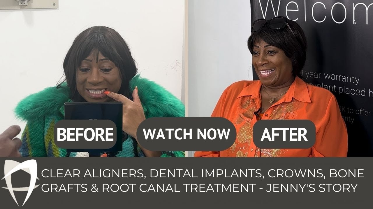 Jenny - Aligners, Implants (x3) and Crowns