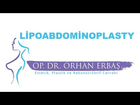 Lipoabdominoplasty (Yağ Alma ile Beraber Karın Germe)