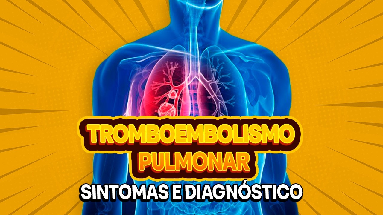 Tromboembolismo Pulmonar: Sintomas, Diagnóstico e Prevenção