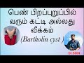 Bartholin Cyst In Tamil Vaginalinfection Cyst Swelling Abscess Pain Doctor Homoeopathy Madurai
