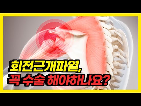 어깨 아픈 회전근개파열, 나도 수술해야할까?