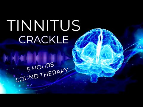 Crackle Sound Therapy: The New Breakthrough for Tinnitus