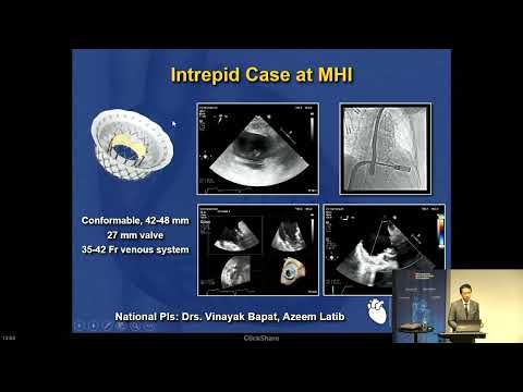 Tricuspid Valve Management | Paul Sorajja, MD & John Zakaib, MD