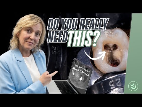 Do You REALLY Need a Root Canal? Dentist Reveals the Truth