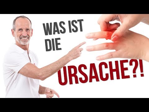 Darum hast du einen Schnappfinger! – Ursachen verständlich erklärt ✅