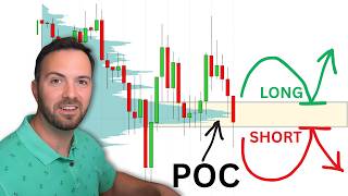 VOLUME PROFILE: How to Trade Point of Control (POC)