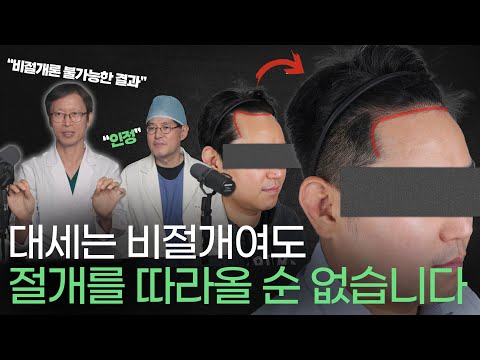 '흉터없는 비절개?' 모발이식은 절개법이 답입니다. 진짜로