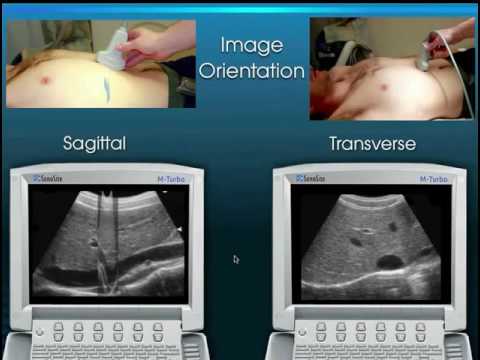 Emergency Ultrasound Course Lecture 1  Ultrasound Knobology by UCI