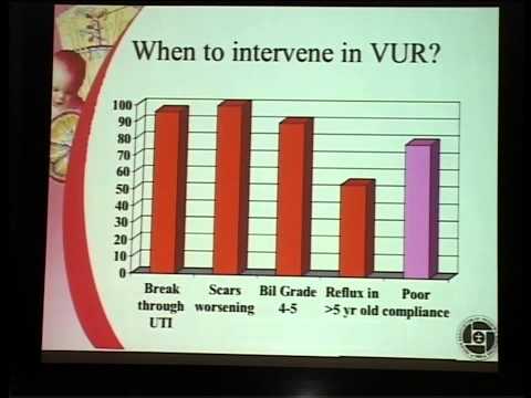 Contentious issues in the management of Vesico ureteric reflux
