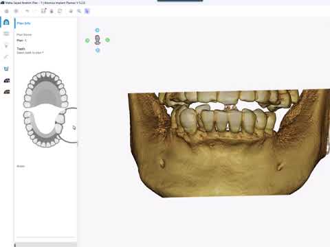 Atomica AI surgical guide software tutorial (In Arabic language)