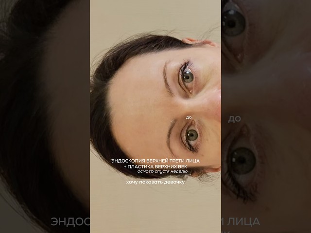 НЕДЕЛЯ ПОСЛЕ ЭНДОСКОПИИ