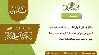 صورة ظهور آثار على الجسم بعد شرب ماء قرئ فيه || فتاوى عامة || د. سامي الواكد