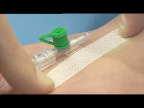 3M™ Tegaderm™ Transparent I V Dressing - 1633 Application and Removal