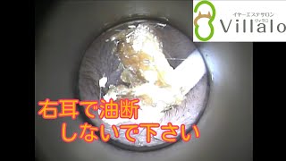 耳掃除動画vol.81「右耳で油断しないで下さい」