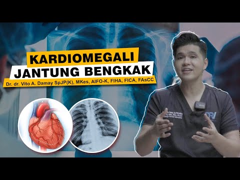 Dr. Vito | Cardiomegaly, Large Heart.