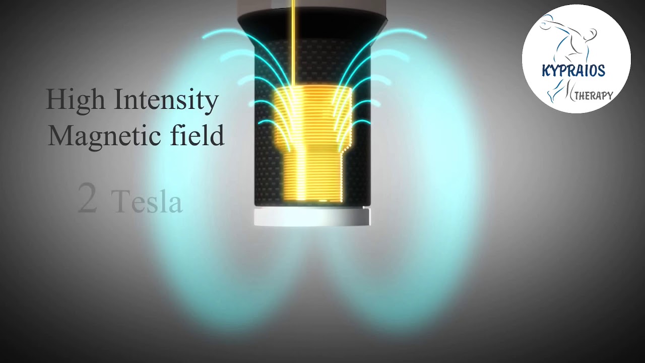 ΔΙΑΜΑΓΝΗΤΙΚΗ ΑΝΤΛΙΑ ΣΩΤΗΡΗΣ ΚΥΠΡΑΙΟΣ