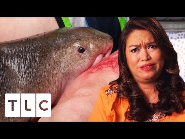 Shark Attack Victim Is Desperate To Save The Shark! | Untold Stories Of The ER