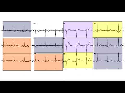 CEN Review Cardiovascular Emergencies Part 1