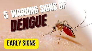 5 warning signs of Dengue | 5 early symptoms of dengue | डेंगू के लक्षण