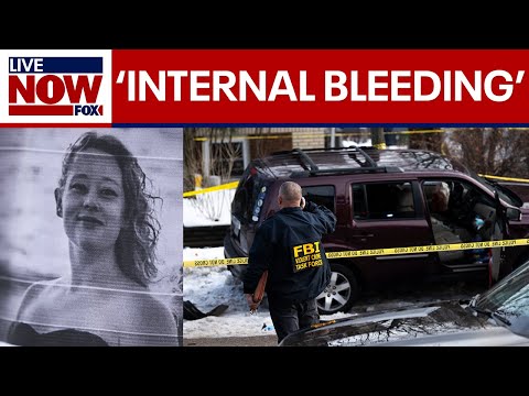 ICE agent who shot Renee Good suffered internal bleeding, DHS says