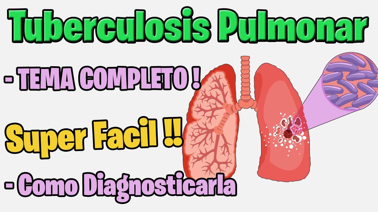 TUBERCULOSIS PULMONAR | SINTOMAS, FISIOPATOLOGIA, TRATAMIENTO