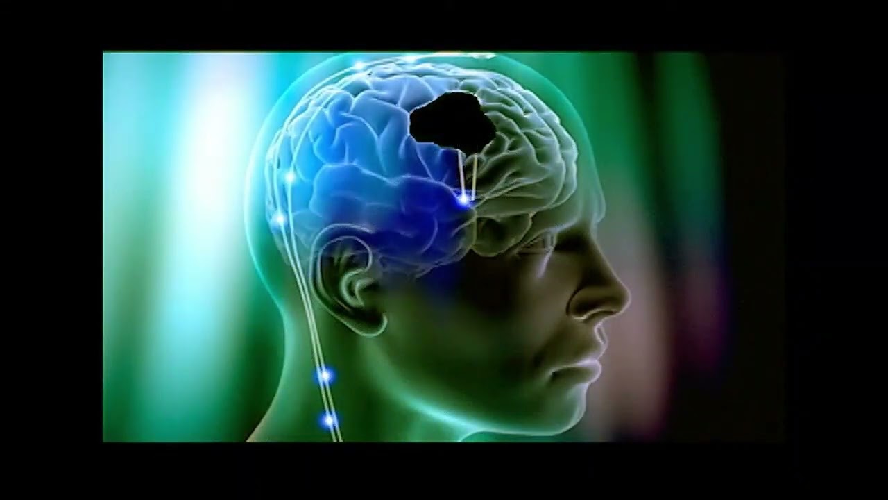 Etapas de aquisição de memória - Fonovim